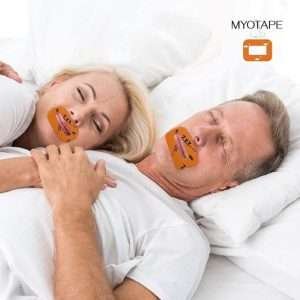Myotape -Myoteippi
